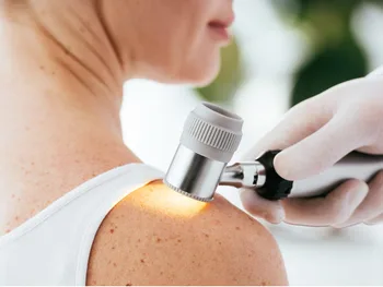 Dermatoskop bada skórę na ramieniu osoby w białej koszulce