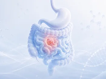 Grafika przedstawia model anatomiczny żołądka i jelit z zaznaczonym obszarem w jelicie.