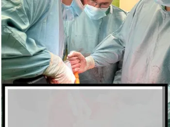 Trzech chirurgów w sali operacyjnej podczas zabiegu, ubrani w maski i fartuchy chirurgiczne.