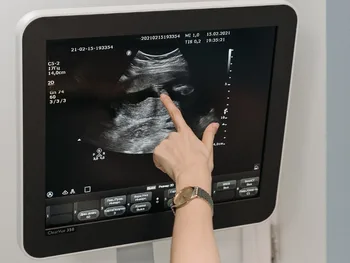 Osoba wskazuje palcem na ekranie ultrasonografu z widocznym obrazem USG.